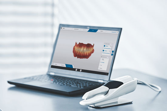 口腔内スキャナー